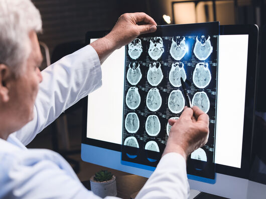 Ein älterer mann im Kittel zeigt mit einem Stift auf Gehirnscans auf einem Monitor.