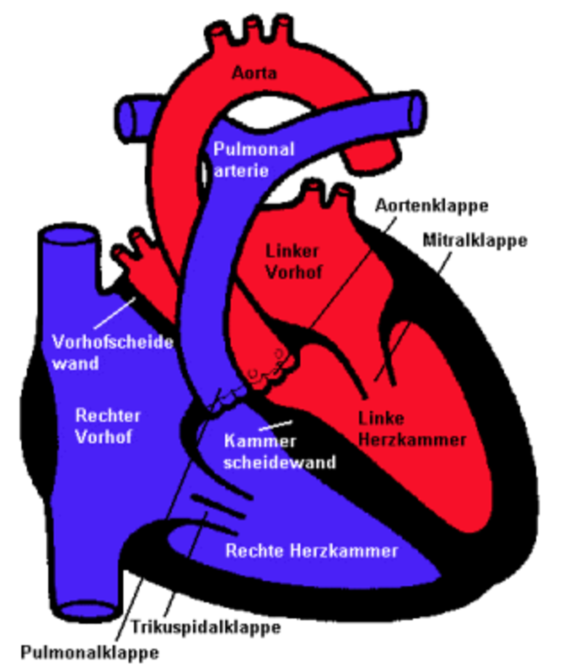 Herzklappenoperation